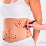 O Impacto da Cirurgia Plástica na Autoestima e no Bem-Estar Emocional